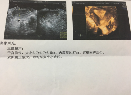 泰国试管婴儿
