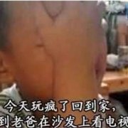 泰国试管婴儿攻略