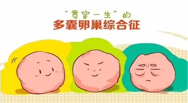 多囊卵巢综合征怀不上怎么办