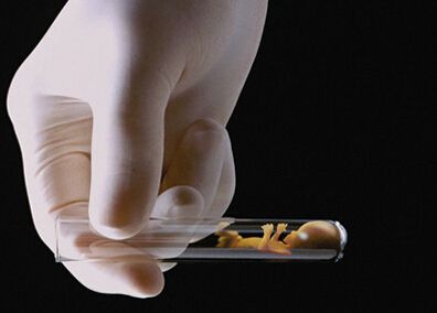 试管婴儿可不可以决定胎儿性别?