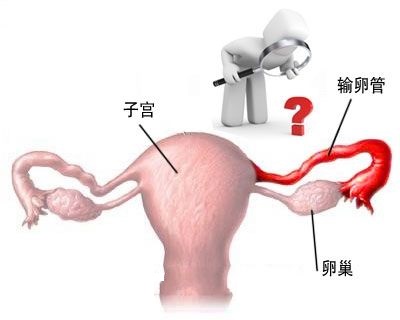 在泰国试管婴儿医院输卵管粘连能怀宝宝吗?