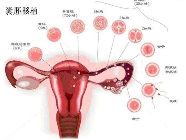 第三代泰国试管婴儿鲜胚移植和冻胚移植哪个较好?