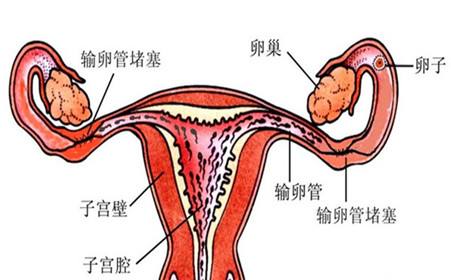 输卵管堵塞是可以做泰国试管婴儿?