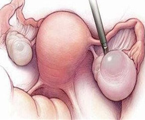 如果取出未成熟卵子能配成囊胚吗?