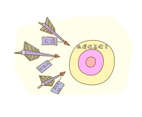 盆腔积液会影响做试管婴儿吗?