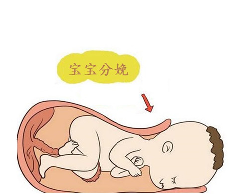 泰国试管婴儿一定要选择剖腹产吗?