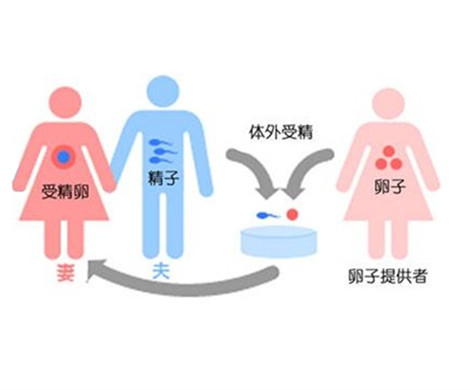 试管婴儿捐卵人与受孕人之间需要血型一样吗?