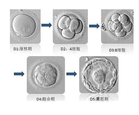 试管婴儿囊胚移植好吗?为什么都选择单囊胚移植?