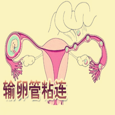 输卵管粘连去泰国试管婴儿医院怀宝宝吗?