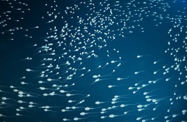 泰国试管婴儿:精子活力低能怀孕吗?原因有哪些